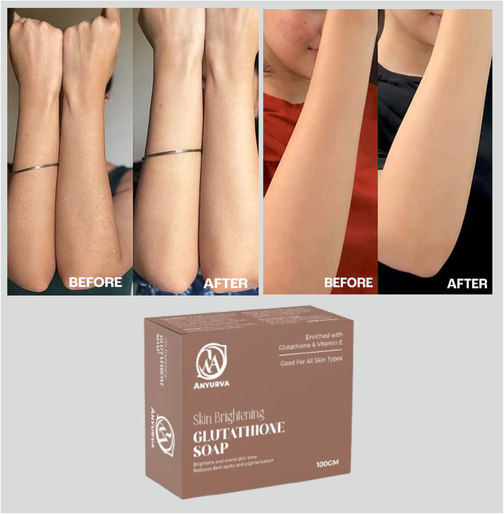 Anyurva Glutathione Soap | Anti-Pigmentation | Vitamin C & E, Kojic Acid |  Skin Brightening, Oil Control, Hydrating & Tan Removal Cleanser – 100gm  (4pcs combo 400gm)