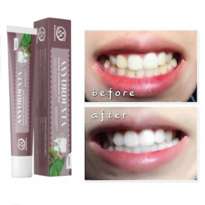 ANYURVA ANYURDENTA HERBAL TOOTHPEST GEL 150gm
